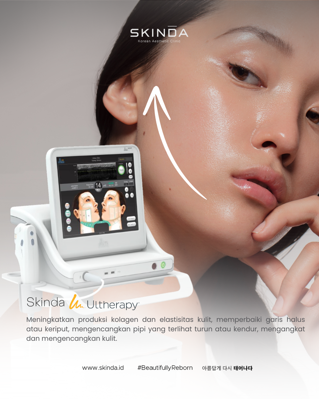 ✨ Elevate Your Timeless Beauty with Ultherapy at SKINDA